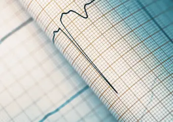 ecg-life
